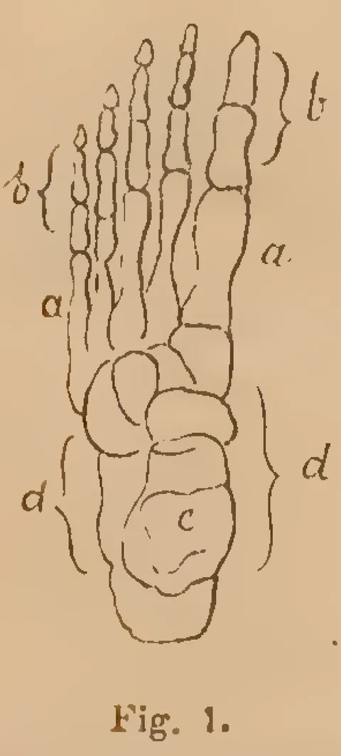 Fig. 1: Foot bones and metatarsal structure