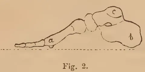 Fig. 2: Foot side profile