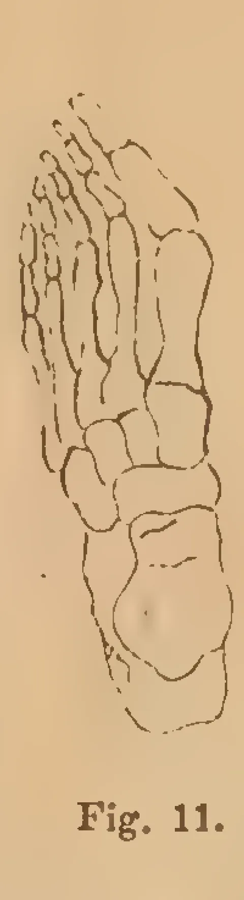Fig. 11: Foot skeletal structure