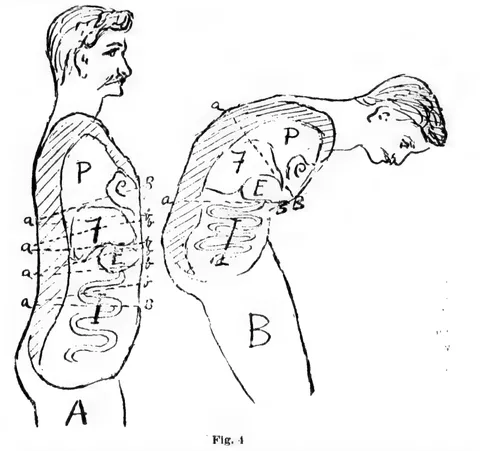 Fig. 4, compression of the chest and abdominal organs when leaning forward on a bicycle