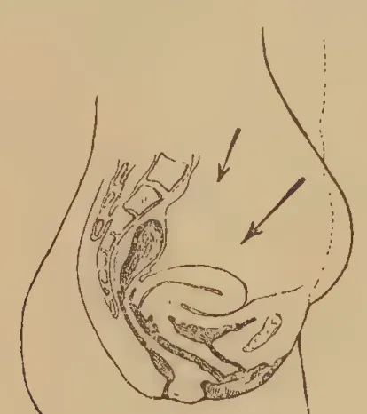 Diagram of the perineum on the saddle